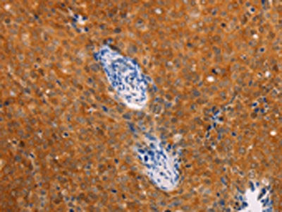 DCT Antibody