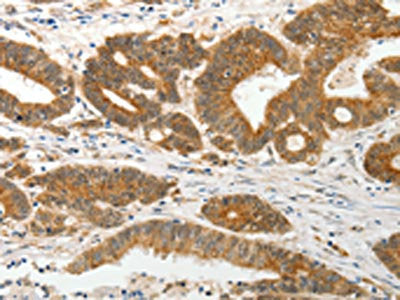 PRPH Antibody