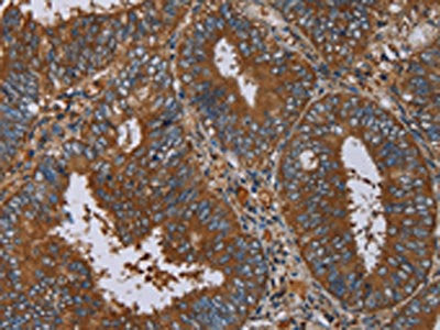 IL27RA Antibody