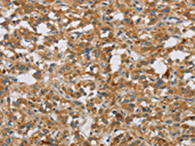 DBH Antibody