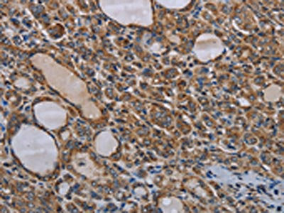 MT-ND6 Antibody