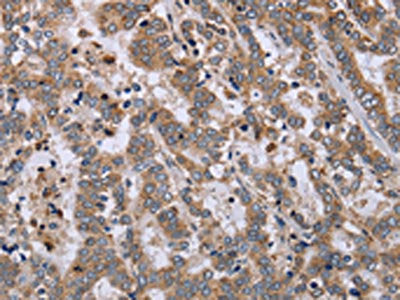 EPSTI1 Antibody