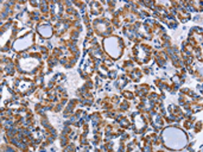 INTS10 Antibody