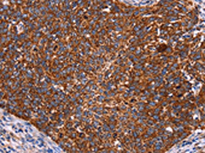 CROT Antibody