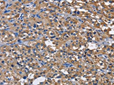CD160 Antibody