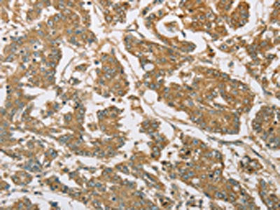 EIF3F Antibody