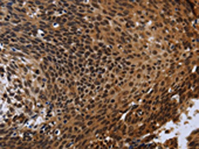 FHL3 Antibody