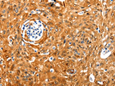NCOR1 Antibody