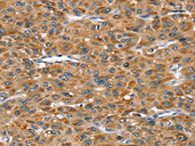 STAB1 Antibody