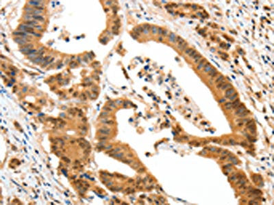 HTR3A Antibody