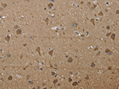PTK2B Antibody