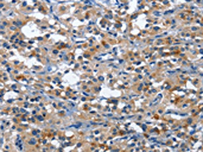 CD177 Antibody