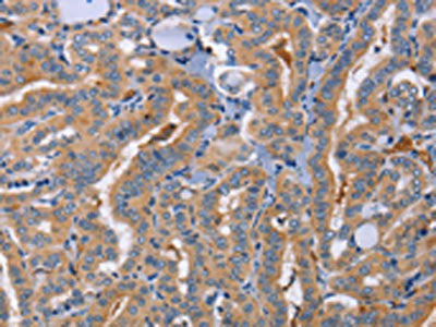 SIGLEC6 Antibody