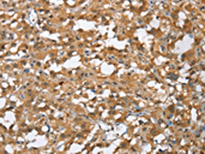 MMP12 Antibody