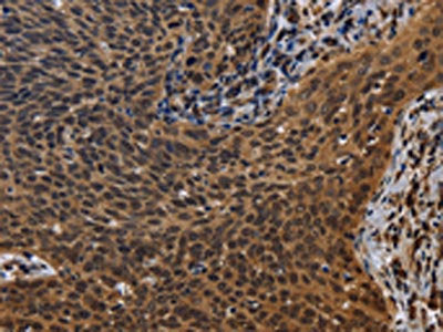 FHL3 Antibody