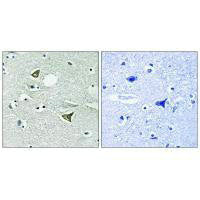 CCDC88A Antibody