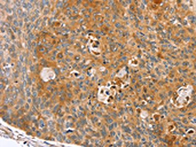 ZFP36L2 Antibody