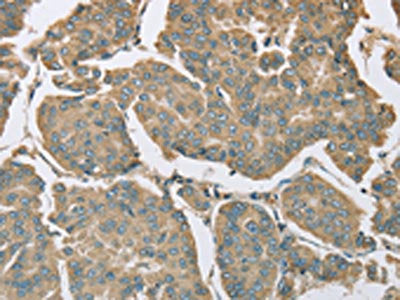 EIF5 Antibody