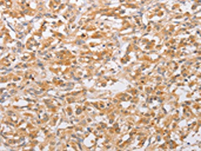 CSGALNACT2 Antibody
