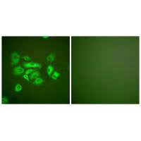 KRT10 Antibody
