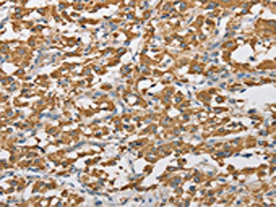 ARHGAP25 Antibody