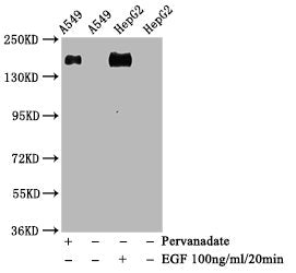 Phospho-EGFR (Y1068) Antibody