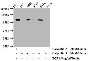 Phospho-ERN1 (S724) Antibody