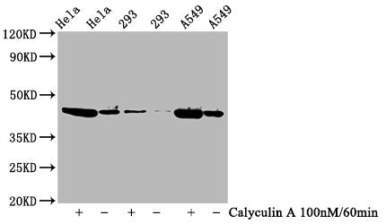 Phospho-GSK3B (Ser9) Antibody