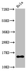 Acetyl-Histone H2B type 1-B（K20）Antibody