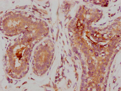 MMP9 Antibody