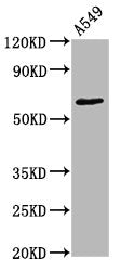 Phospho-PRKCZ (T560) Antibody