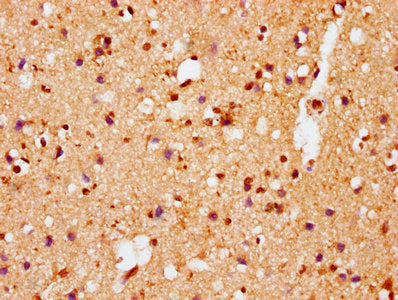 Phospho-SNCA (S129) Antibody