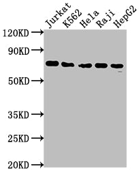 FUBP1 Antibody