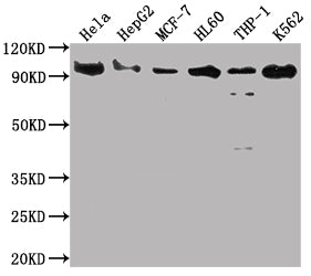 SUZ12 Antibody