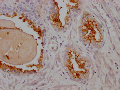 FOLH1 Antibody