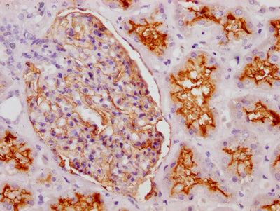 MME Antibody