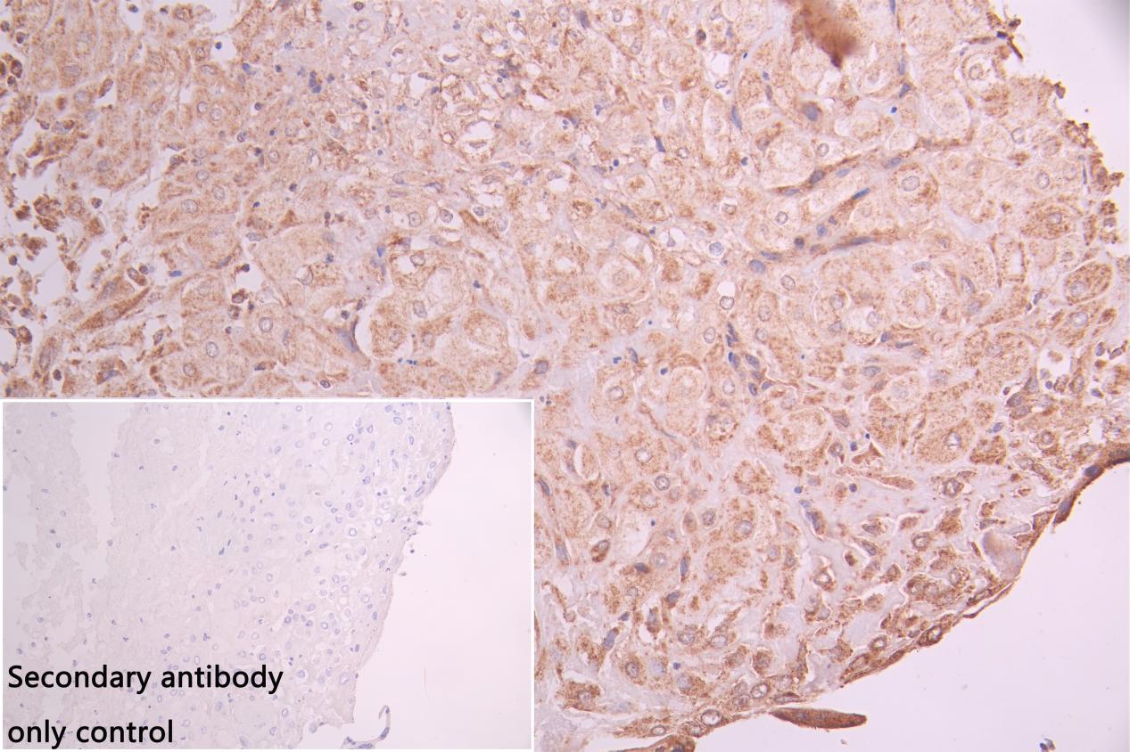 ANGPT2 Antibody