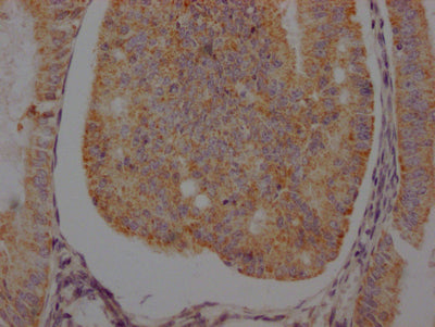 ADRB2 Antibody