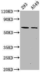 Phospho-PRKAA2 (S491) Antibody
