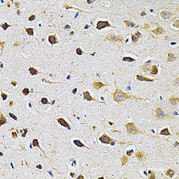 (KO Validated) ADRBK1 Polyclonal Antibody