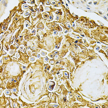 (KO Validated) ADRBK1 Polyclonal Antibody