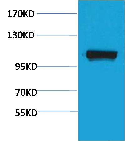 PEPC  Rabbit pAb