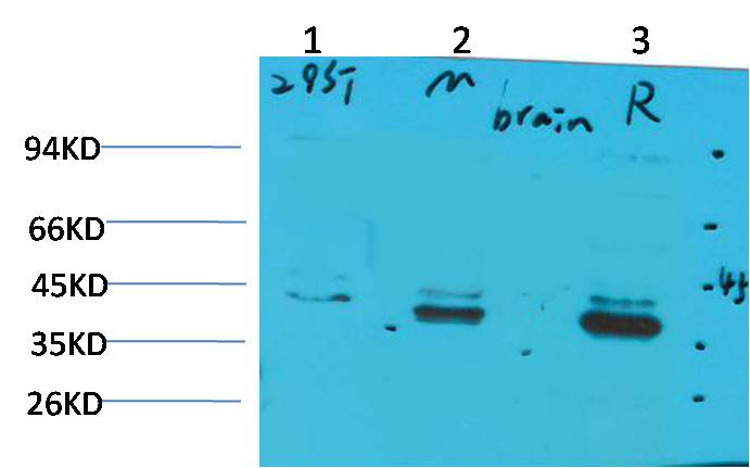 CABP2 Rabbit pAb