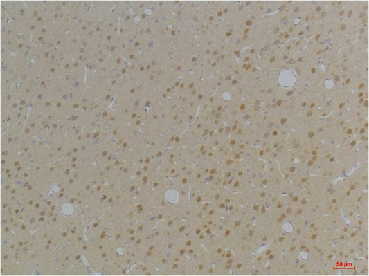 KVβ1 Rabbit pAb