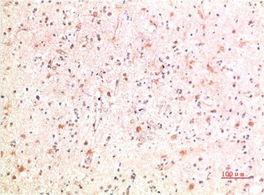 PI3 Kinase P85 Rabbit pAb