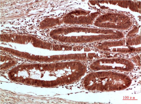 Acetyl-CoA Carboxylase Rabbit pAb