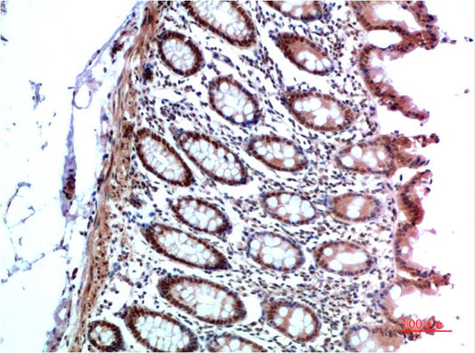 HP-1 α Rabbit pAb