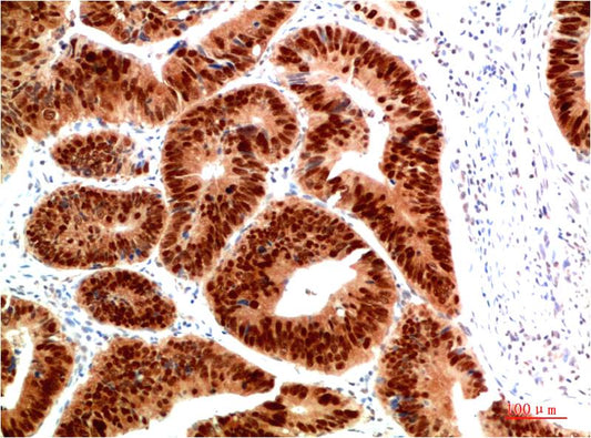 HSP40 Rabbit pAb