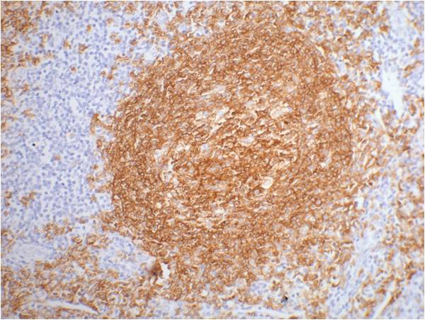 CD20 Mouse mAb