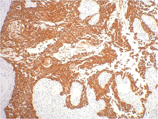 CK16 Mouse mAb